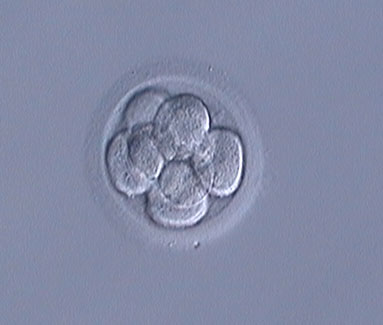 Frozen Embryos